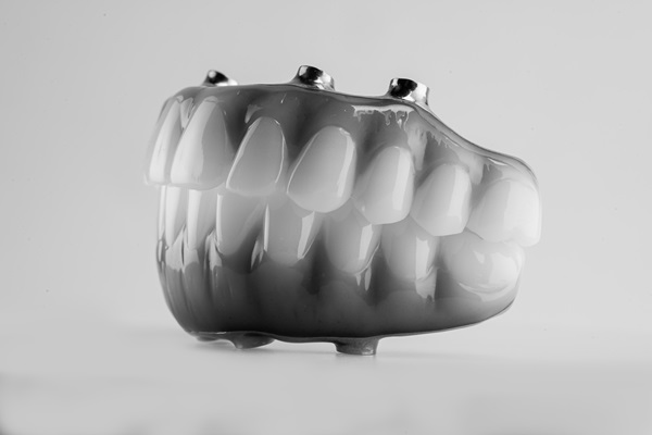 Benefits Of Dentures With All On   Implants