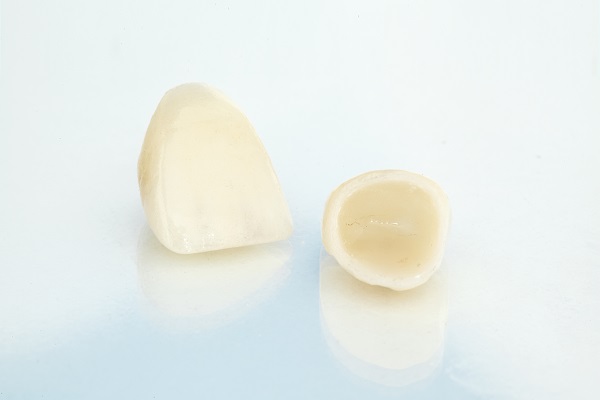 Ask Your Dentist: Pros And Cons Of CEREC Crowns