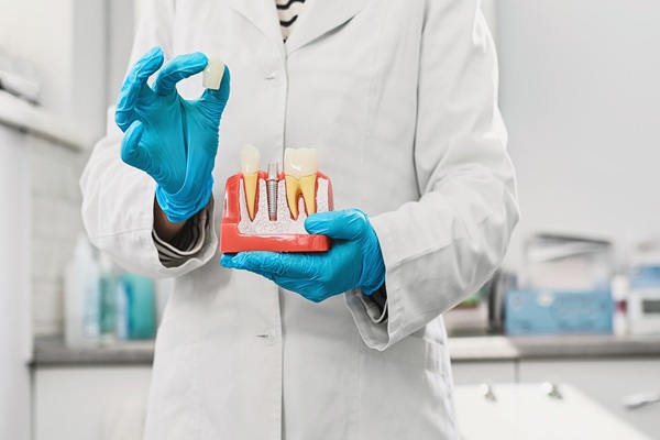 Proper Dental Implant Care In Your Oral Hygiene Routine