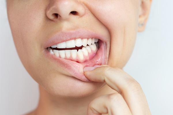 Gum Disease Treatment Options From A Family Dentist