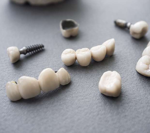 Atlanta The Difference Between Dental Implants and Mini Dental Implants