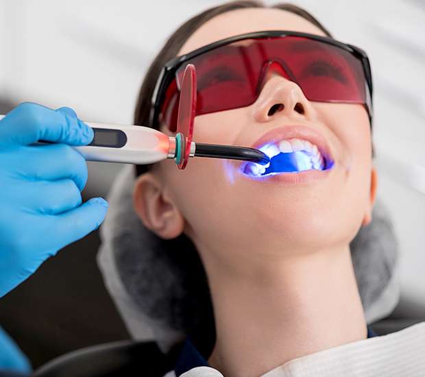 Atlanta Professional Teeth Whitening