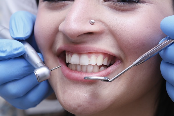 How To Prepare For A Smile Makeover
